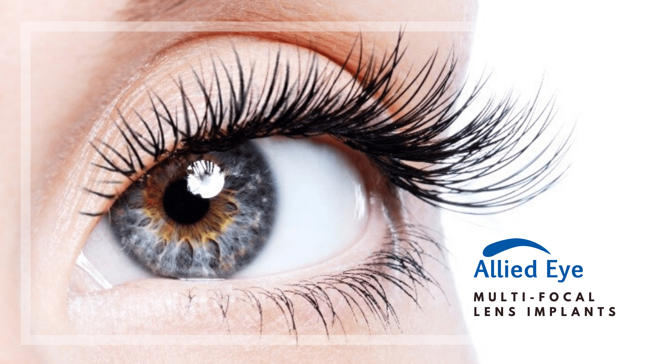 Everything To Know About MultiFocal Lens Implants